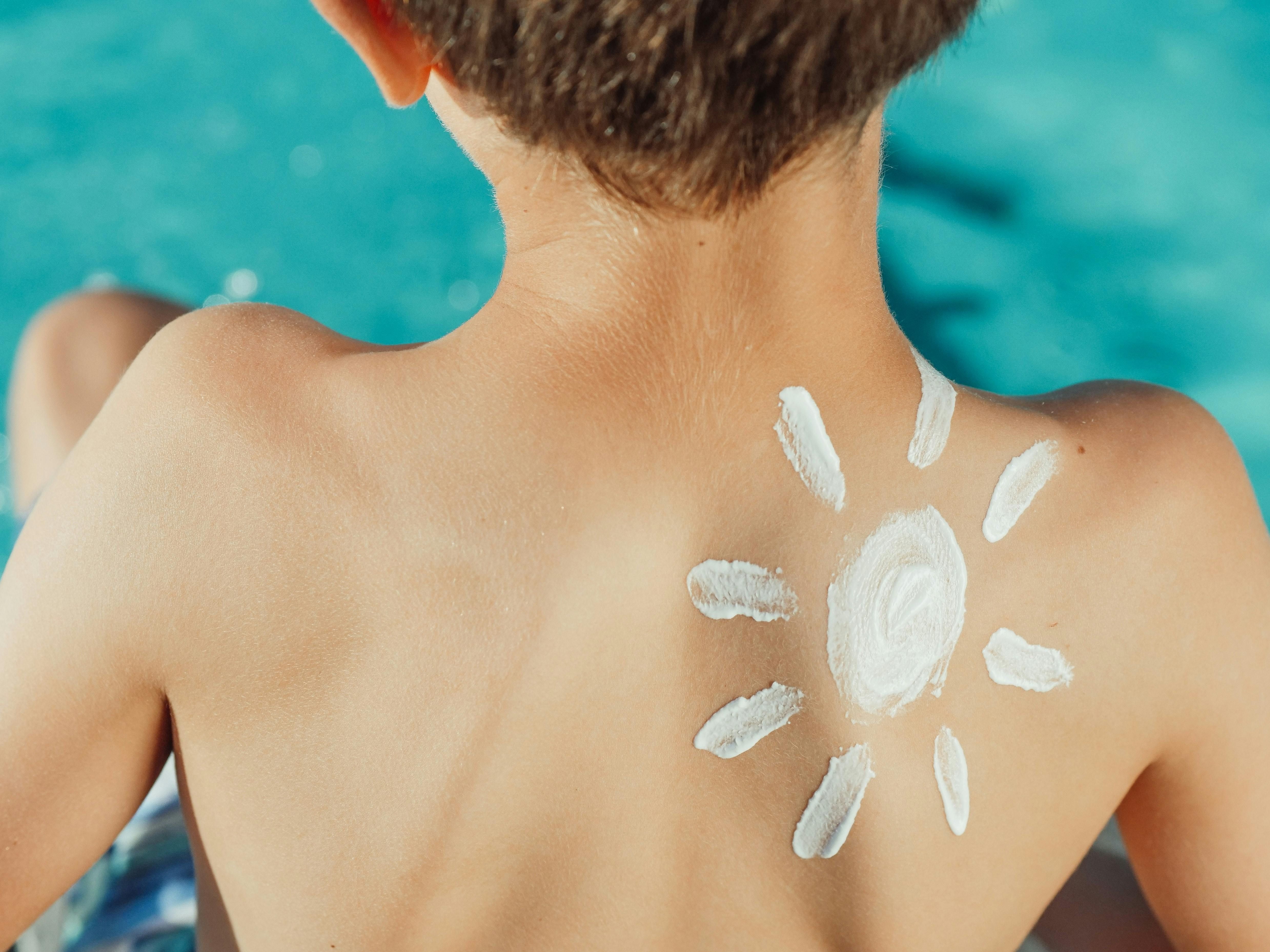 Is sunscreen essential in your bag? (Image via pexels/ Kindelmedia)