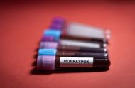 Monkeypox - Mpox (Image via Getty)
