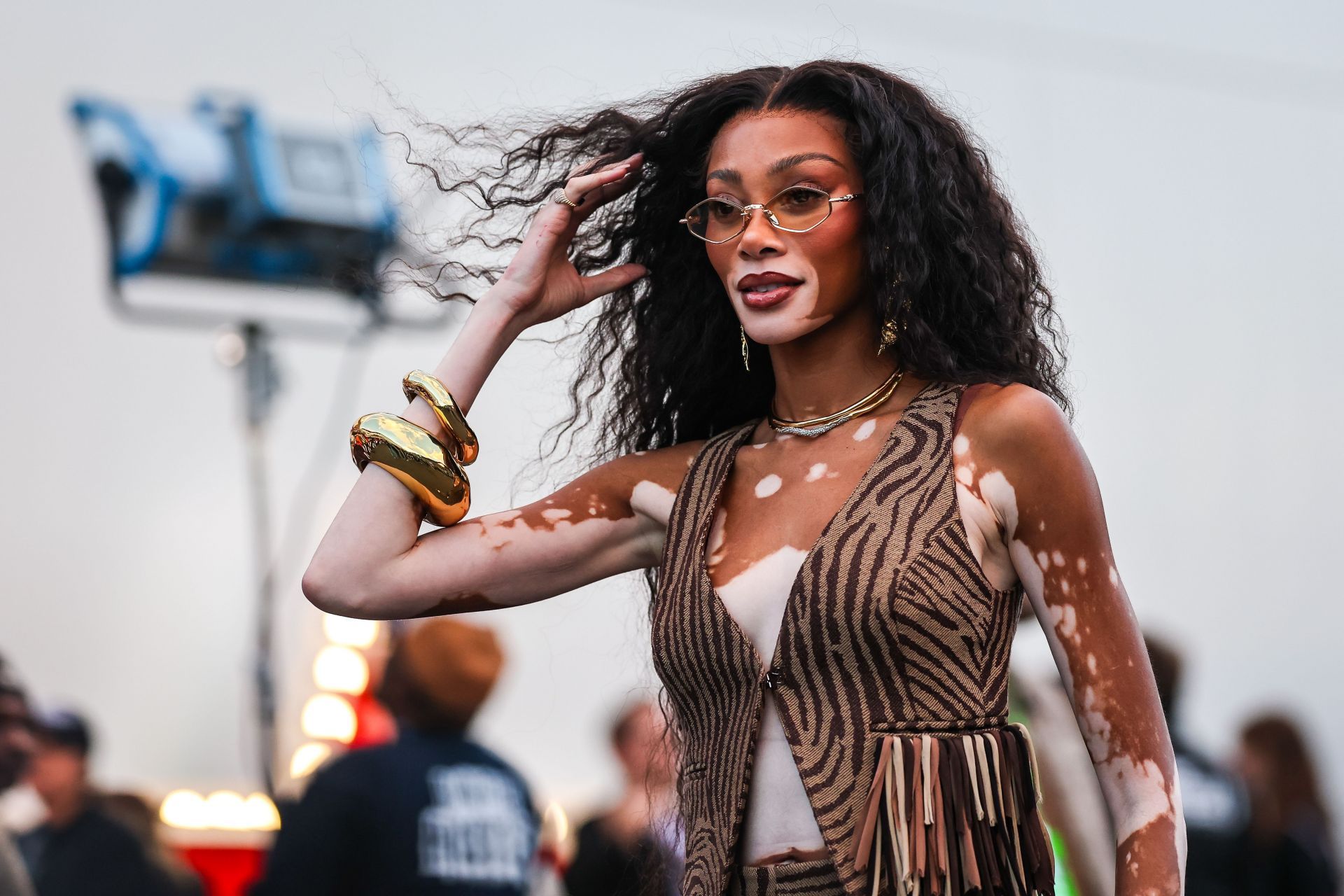 Winnie Harlow is a public spokesperson on vitiligo (Image via Kym Illman/Getty Images)