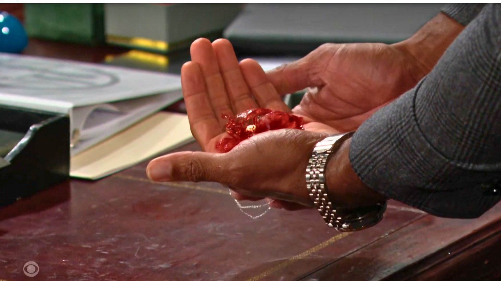 The wound cut deep for Carter...and his hand on The Bold and the Beautiful | Image: CBS