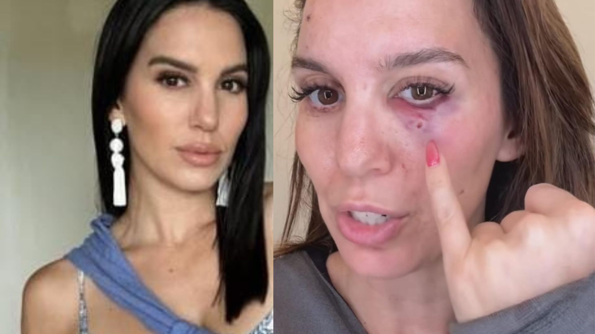 Christy Carlson Romano brfore and after her accident (via Instgram)