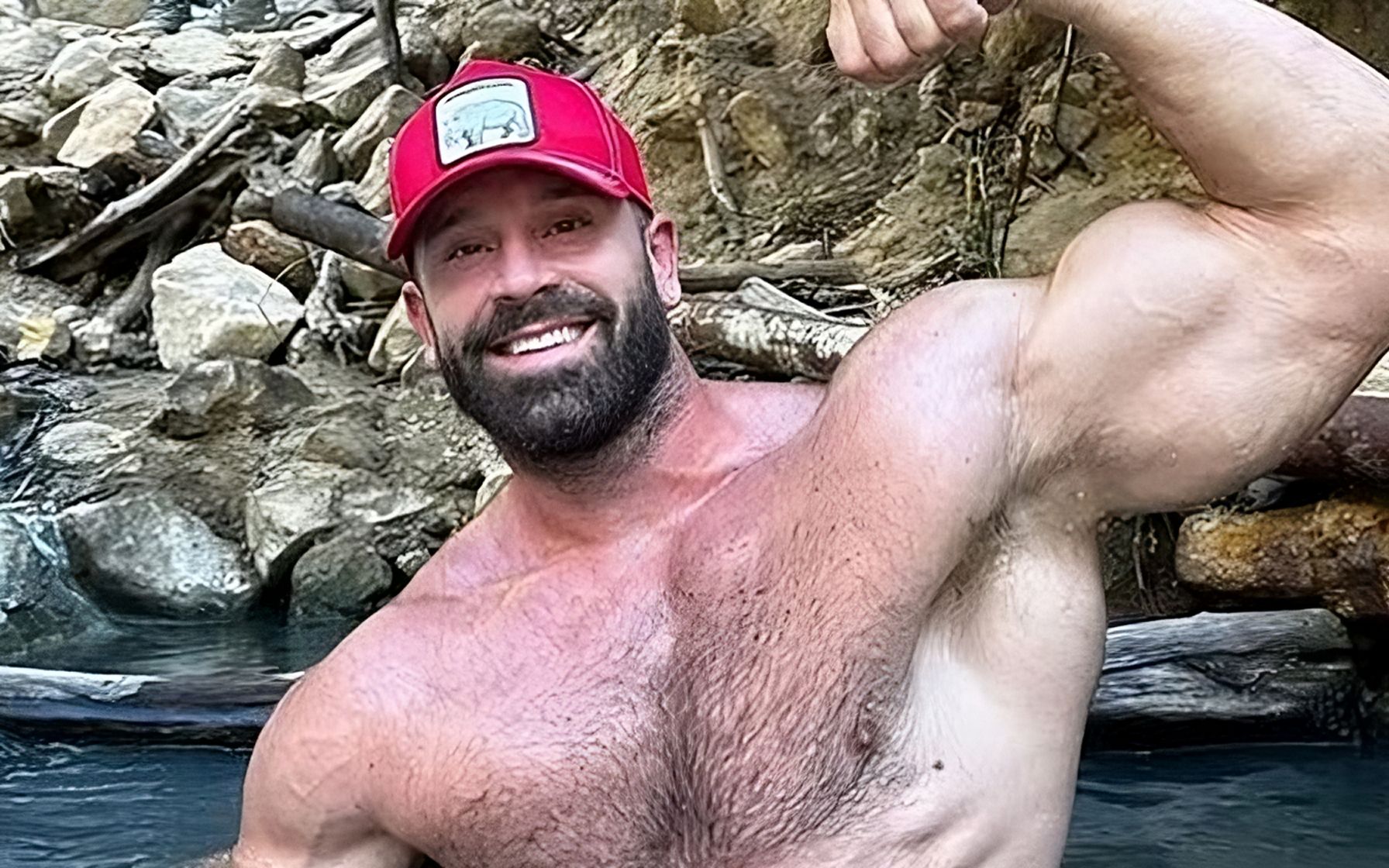 Bradley Martyn loses his pinky finger (image via @bradleymartyn on Instagram) 
