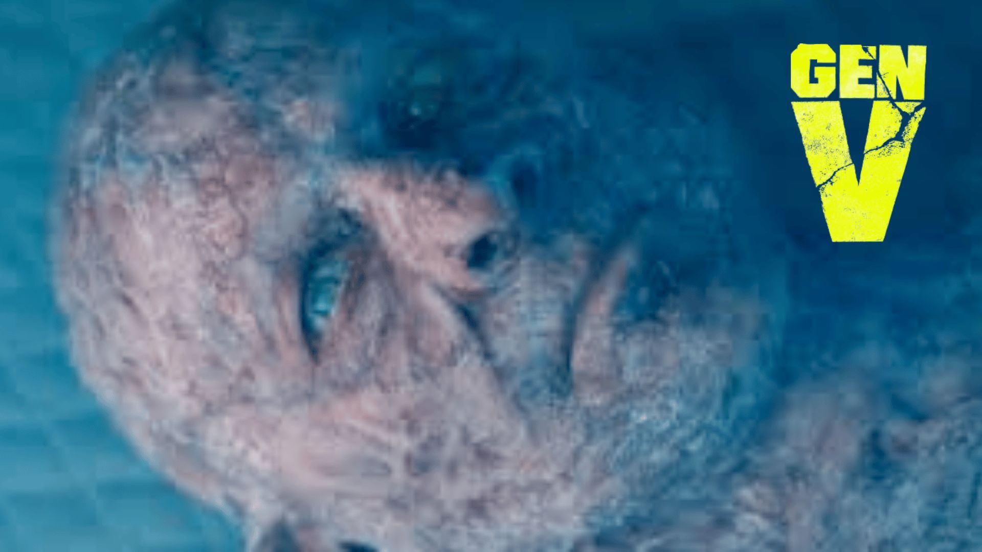 The burned man in Gen V Season 2 | Image via: Prime Video