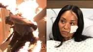 Michael was burnt in an explosion while Jordan had a car crash | Image: ABC