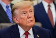 Trump had been diagnosed with chronic venous insufficiency (Image via Getty)